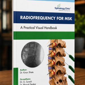Radiofrequency for MSK